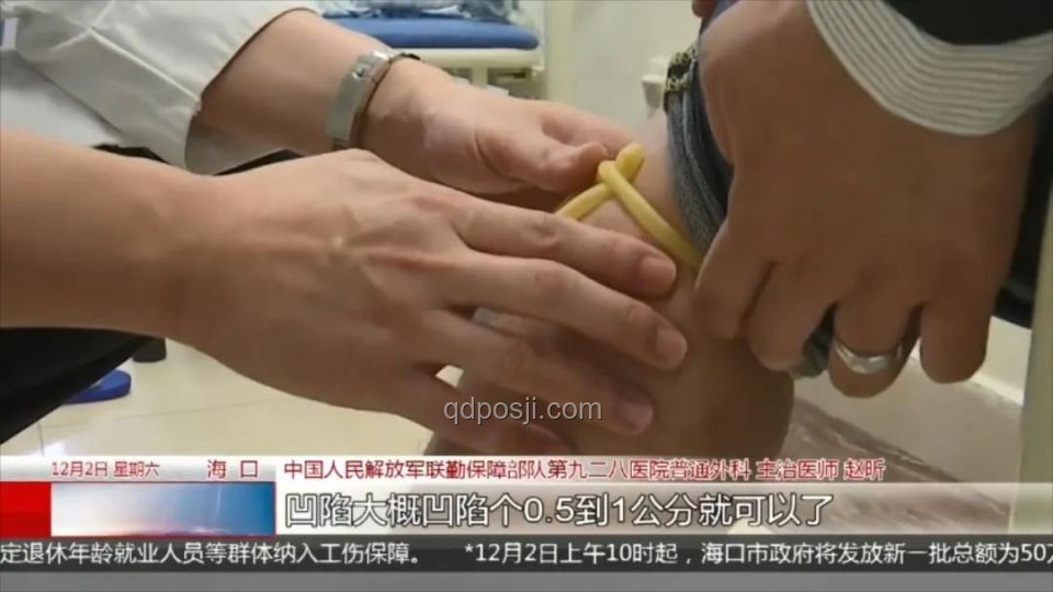 三亚被咬女子案：了解神经毒蛇咬伤知识
